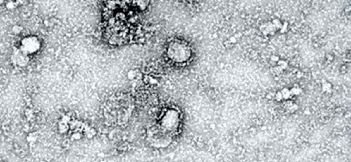 коронавирус на сардинии
